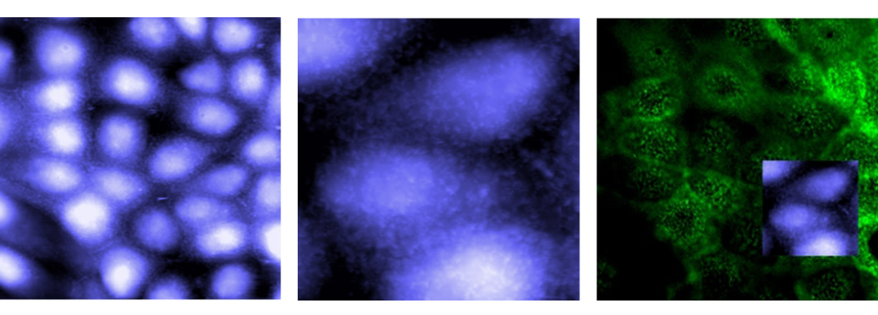 Episode 3: Insights of a Scientist, Nanomechanics in Living Cells feat ...