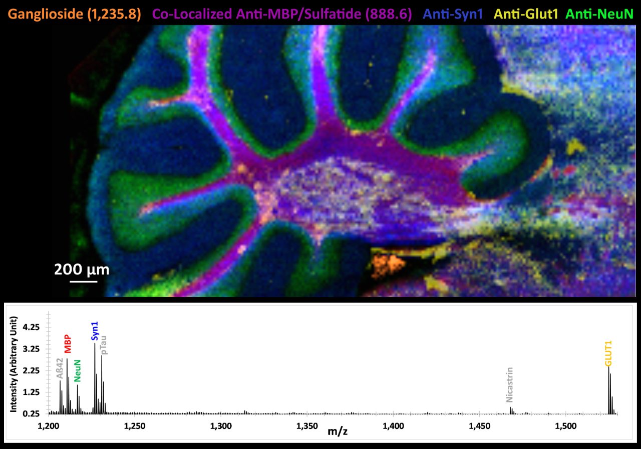 Sagittal mouse brain section