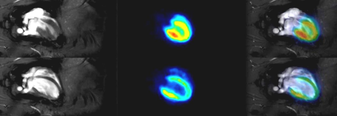 Cardiac PET/MR Imaging in Small Rodents | Bruker