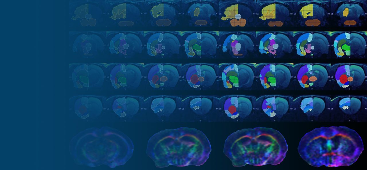 From Anatomical Imaging to the Mapping of Molecular Events