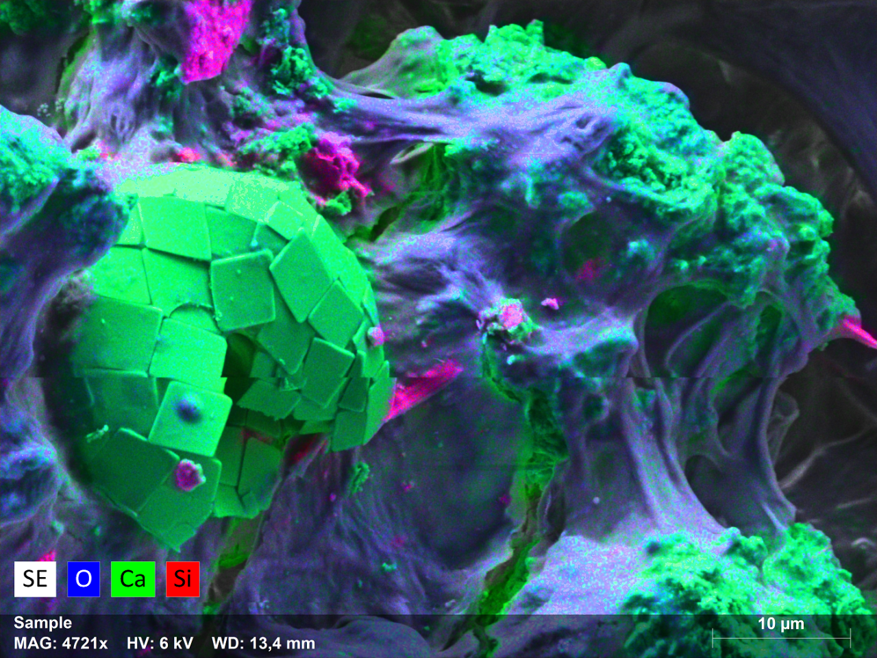 Region of a microbial mat. A large roughly spherical calcium carbonate crystal composed of smaller flat square untis can be seen forming out of the mat.  