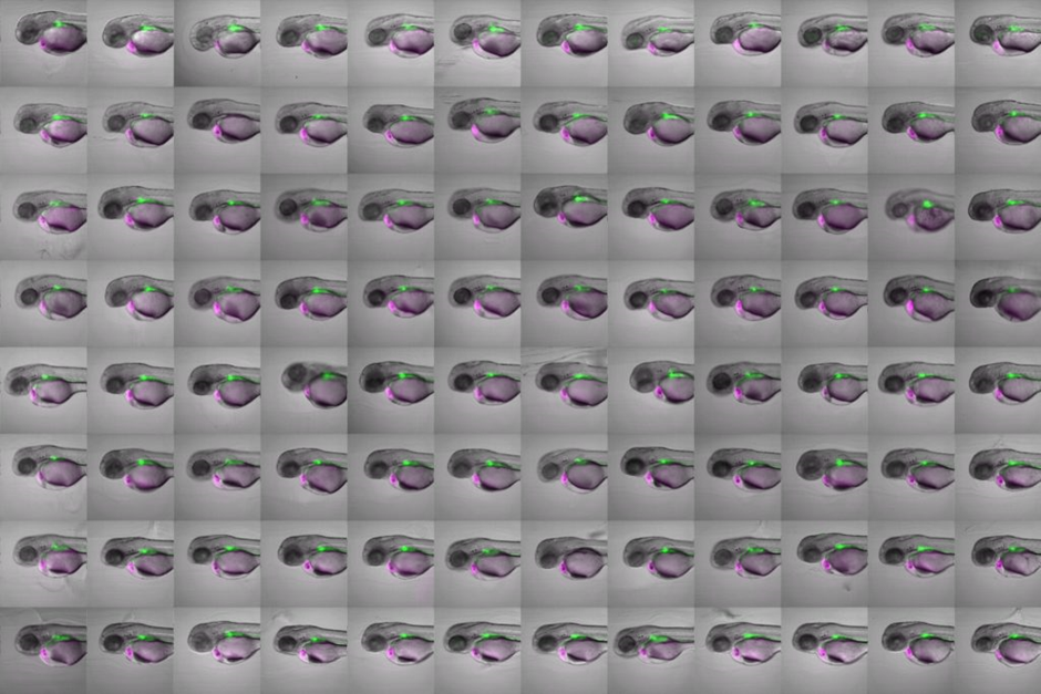 High-content screening for chemical modulators of heart development in zebrafish