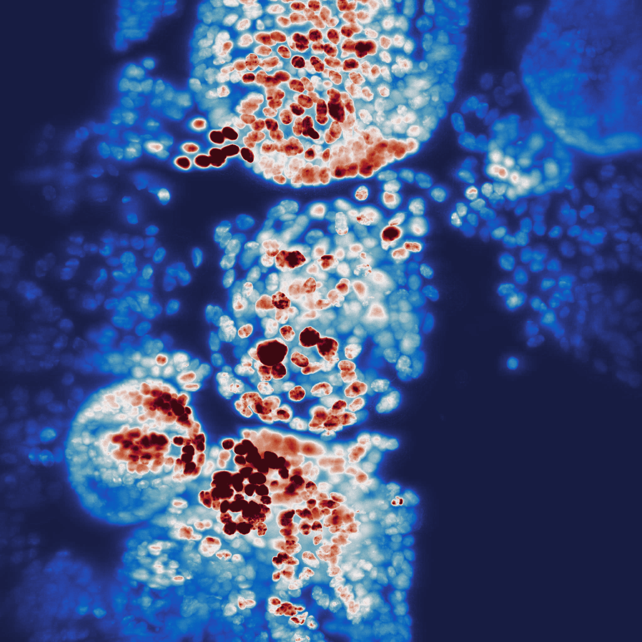 Organoid samples imaged with a light-sheet microscope