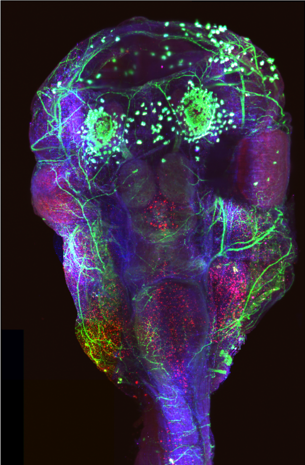 Projection of Xenopus with light-sheet microscope