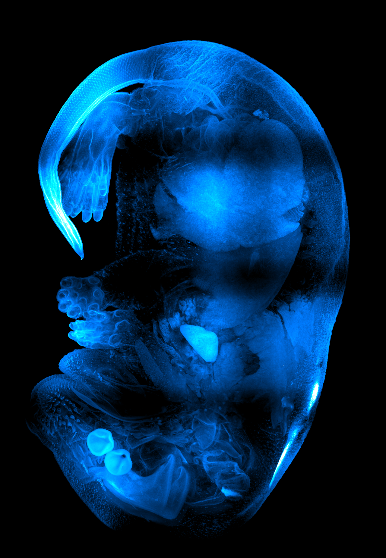 Maximum intensity projection of cleared mouse sample before the Flatfield Correction was applied