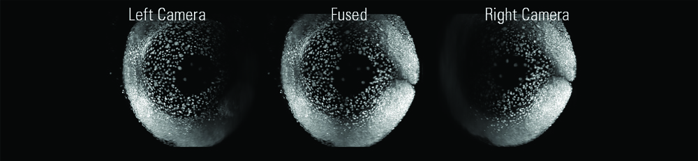 Zebrafish expressing  H2A::GFP acquired  simultaneously from two  opposing directions (left,  right). Data fusion of the  two views yields a high quality in-toto image of  the sample (middle).