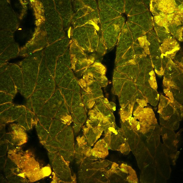 High resolution two-photon excitation fluorescence intensity image of mouse epithelium.  Intrinsic NADH fluorescence is in green, while autofluorescence from keratin is in red/yellow.