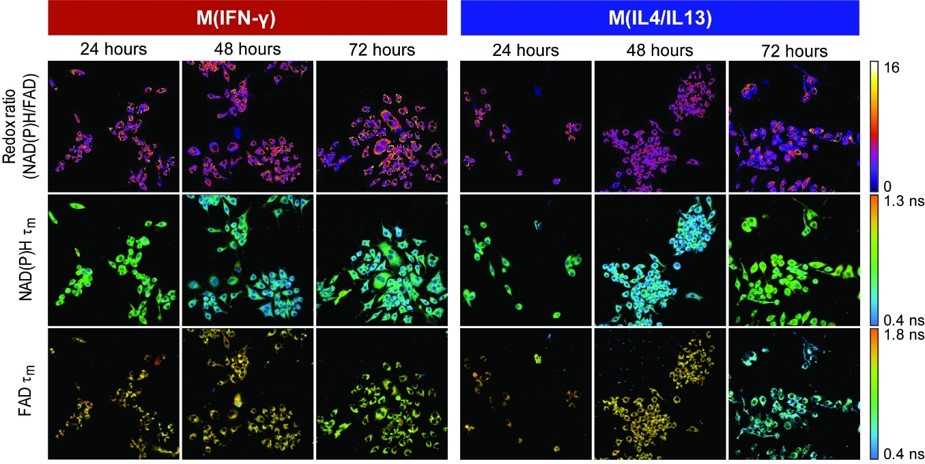 Metabolic autofluorescence imaging in macrophage in 2D culture