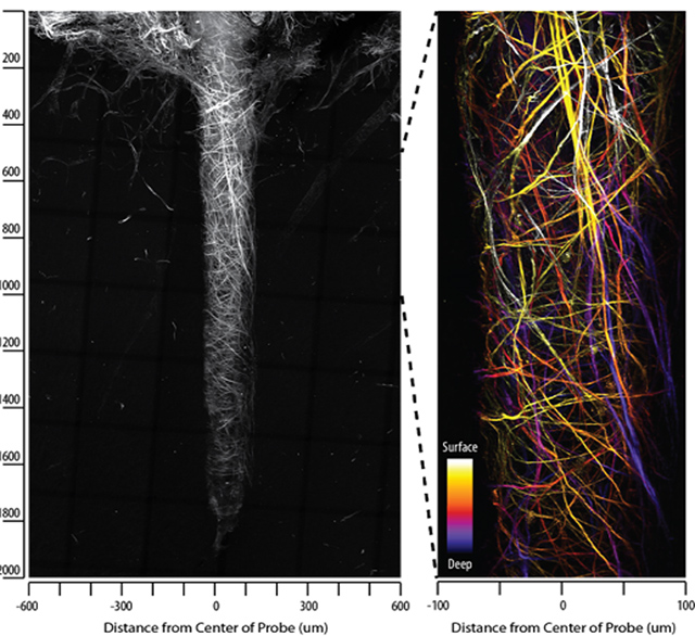 Collagen fibers observed with SHG imaging