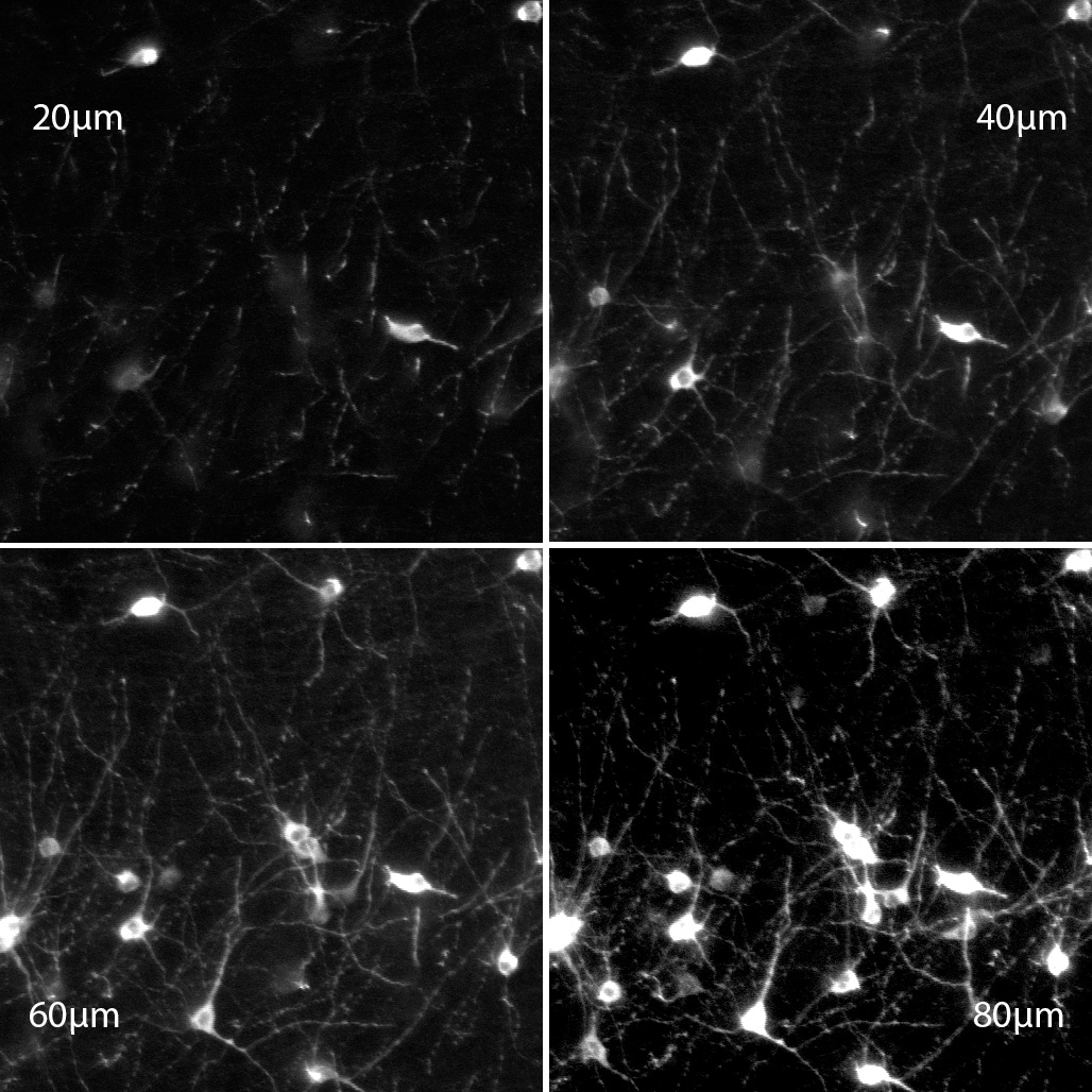 NeuraLeap visual of the mouse ventral tegmental area