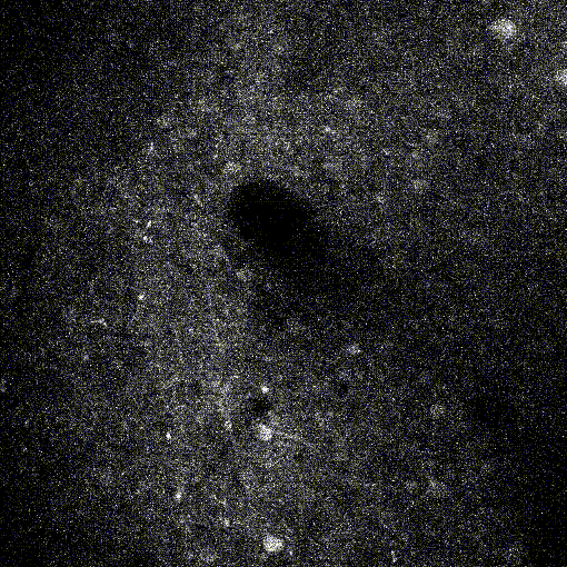 Three-Photon Imaging | Bruker