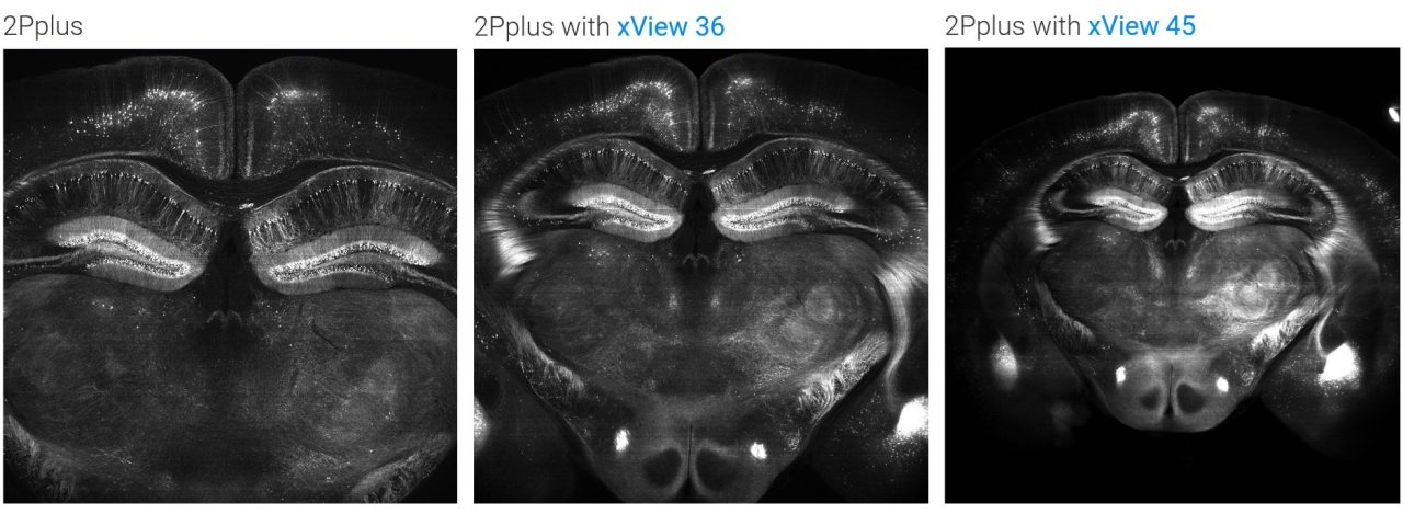 Three images side-by-side, showing a mouse brain imaged with Ultima 2Pplus and a 4X 0.28 NA Olympus objective using xView 36 and xView 45 lenses.