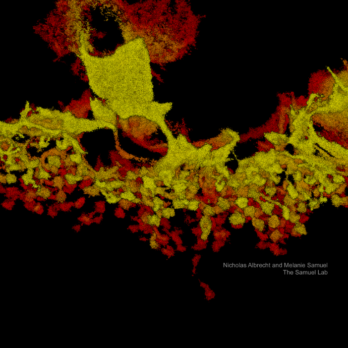 Retinal tissue slice. Calbindin-labeled horizontal cell in murine retinal tissue.