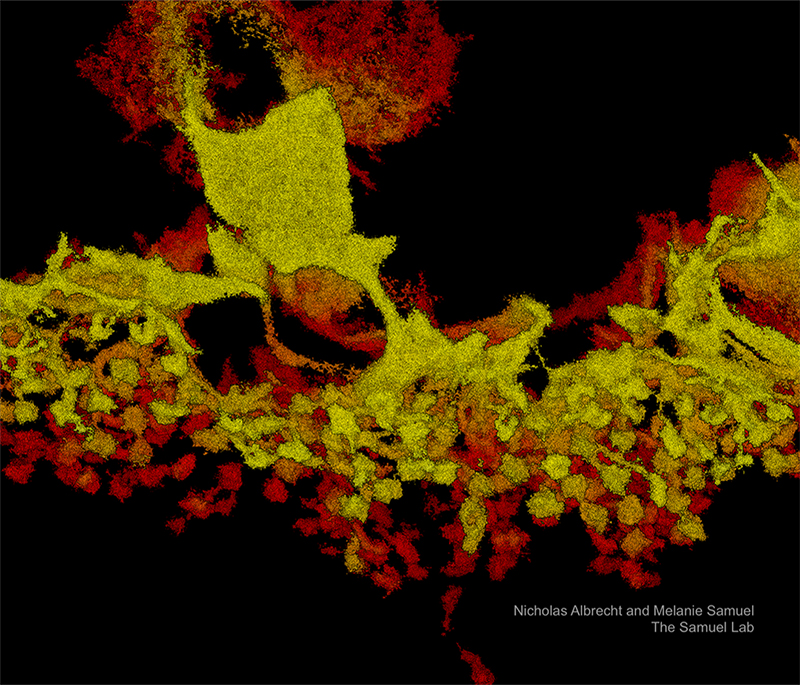 A calbindin-labeled horizontal cell, which is a type of interneuron in the retina