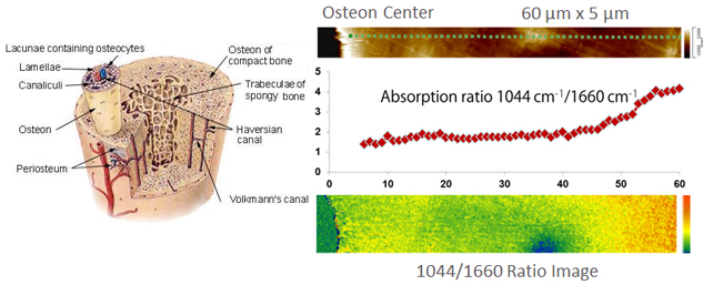 nanoIR - Osteon Bone