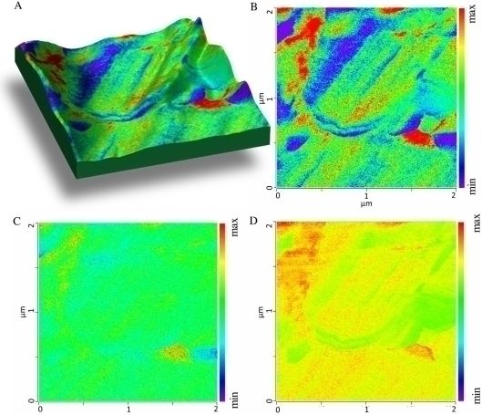 Differentiation of Protein Secondary Structure in Clear and Opaque Human Lenses: AFM–IR Studies