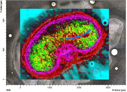 Figure 2 Example of cluster result – IR image of tissue.