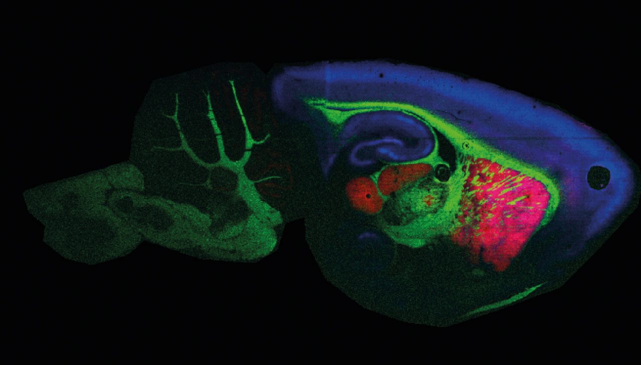 rapifleX MALDI Imaging Rat Brain