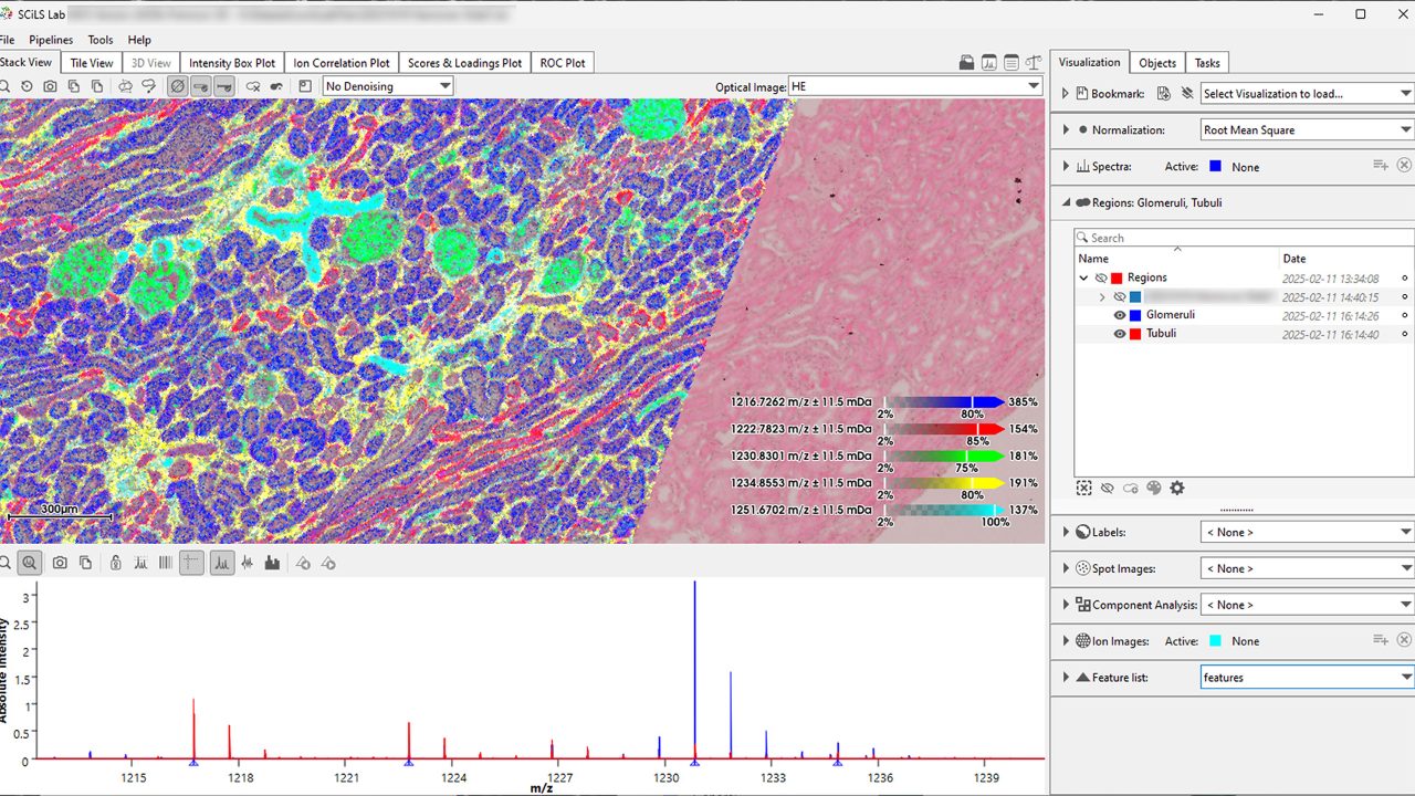 SCiLS Lab is the industry’s tool of choice for deriving new insights from mass spectrometry imaging data. Used across science and industry, the software sets new standards in analysis and visualization, simplifying everyday work and boosting research output.