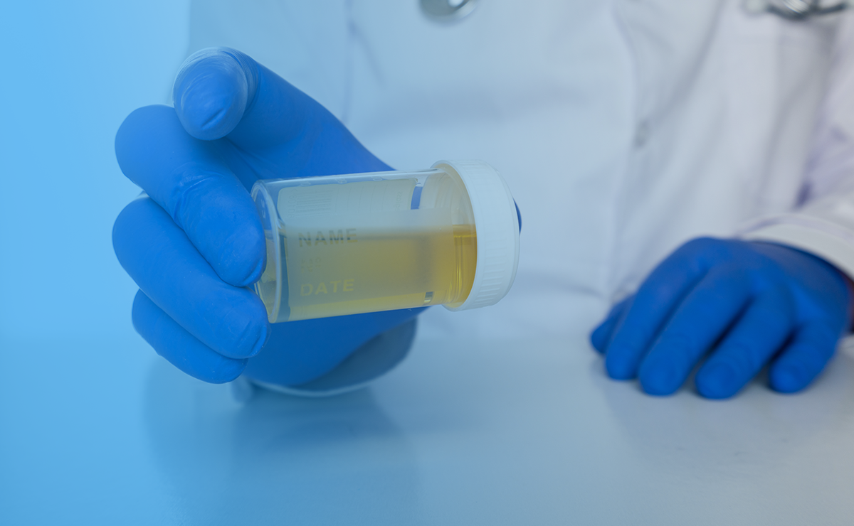 urine testing