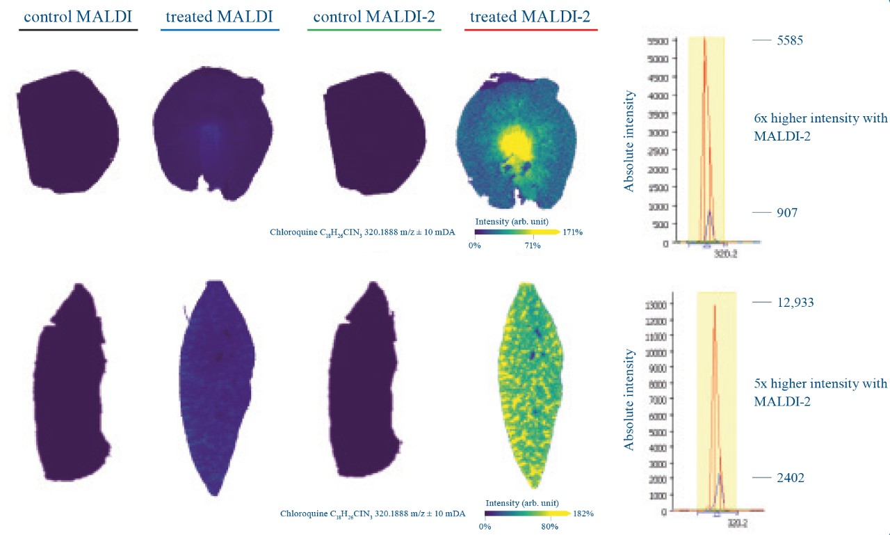 timsTOF fleX MALDI-2 Pharma Drug Imaging