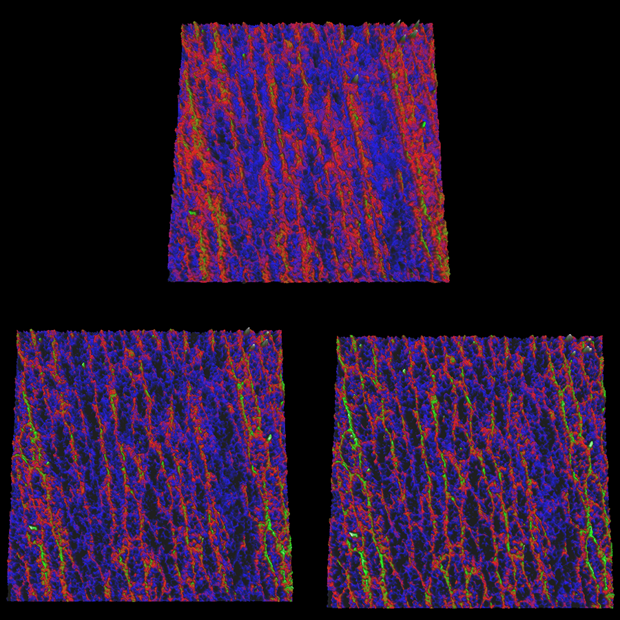 AFM images of human dental enamel