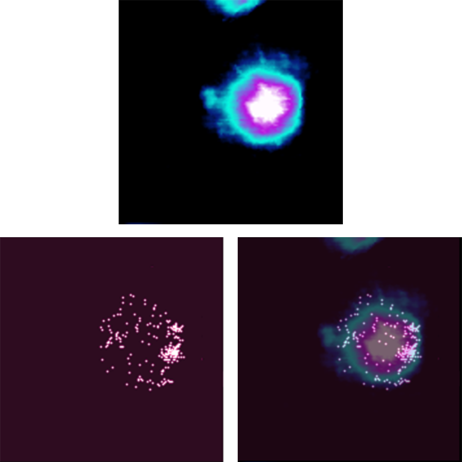 AFM recognition images of a biotin bead