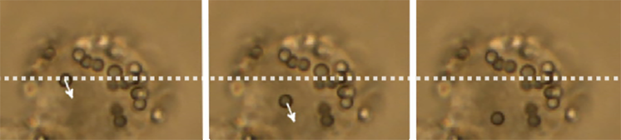 Image shows particle manipulation inside a macrophage. Engulfed particles are moved with optical traps, with the arrow showing movement from the initial position (dashed line).