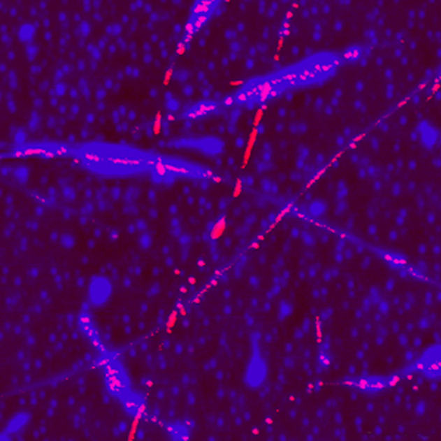 Torsional Resonance Tunneling AFM (TR-TUNA)