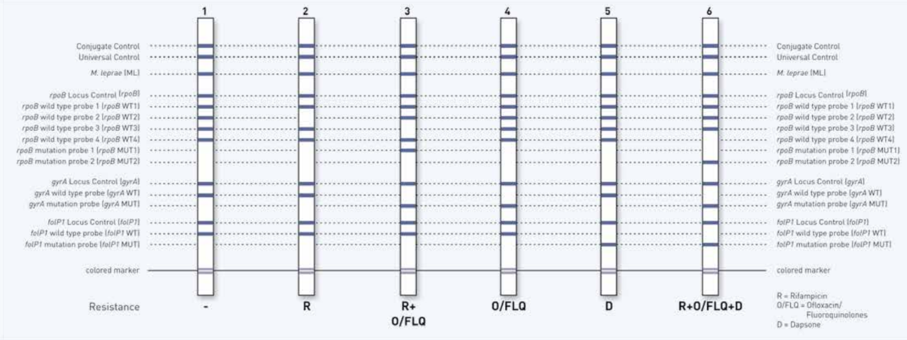 GenoType LepraeDR VER 1.0 example banding pattern