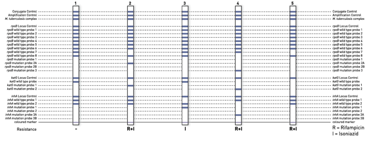 GenoType MTBDRplus VER 2.0 banding pattern