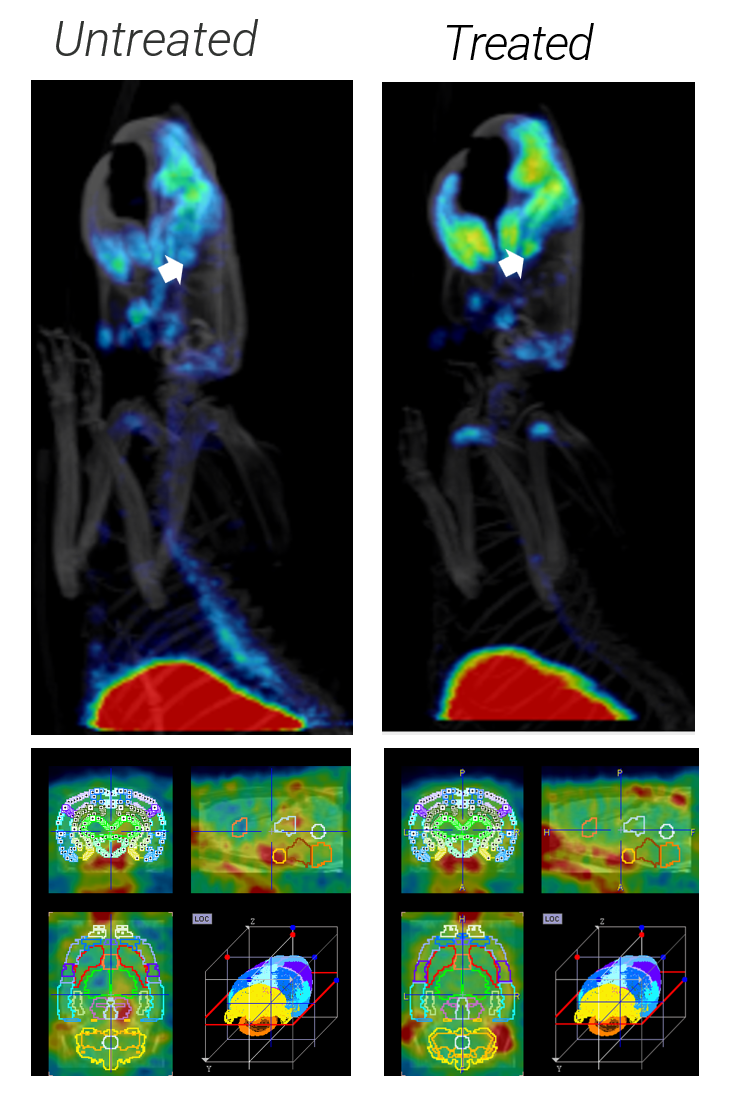 Neurodegenerative Therapy