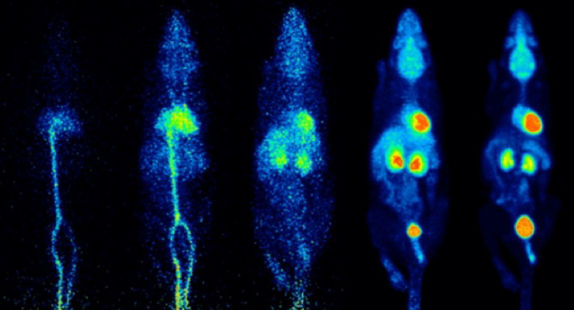 PET / SPECT quantification