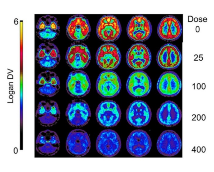 Brain PET occupancy studies