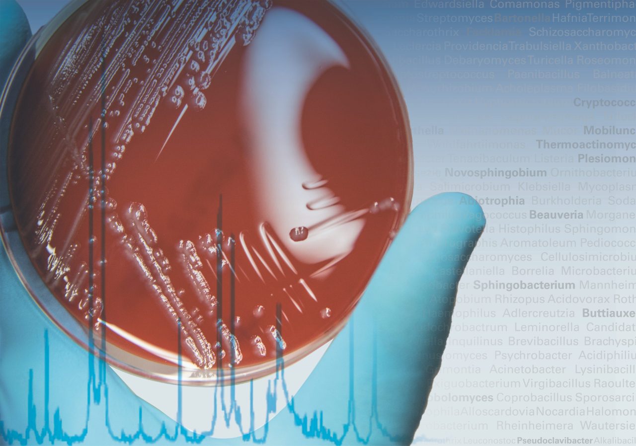 Microbiology & Diagnostics Bruker