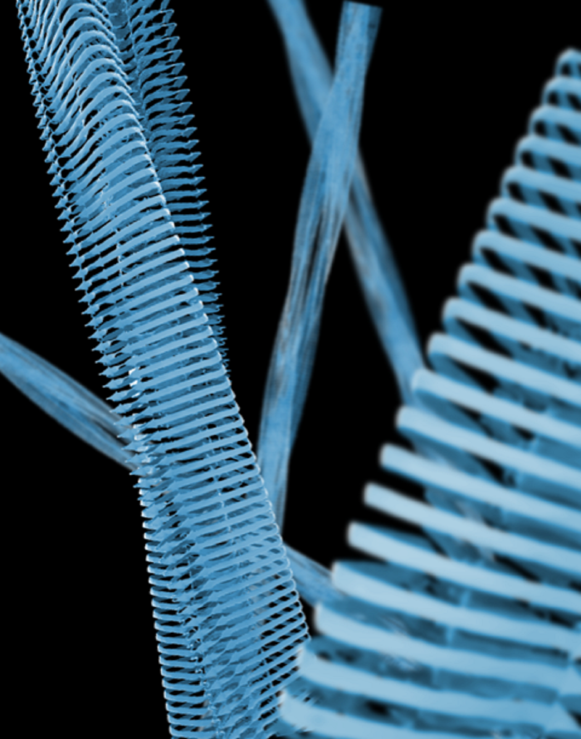 1.2 GHz NMR functional structural biology research of amyloid fibrils for the study Alzheimer’s disease (AD).