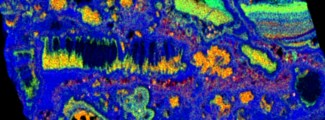 Introducing XTrace 2 the Next-Generation for Enhanced Micro-XRF on SEM ...