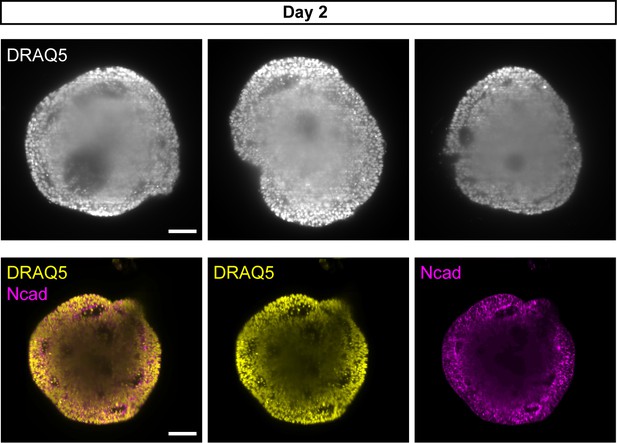 3D imaging of organoids using SPIM to study organoid interior composition.