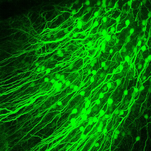 3D-view of volumetric stack, layer 5B neurons in mouse visual cortex in vivo, labelled (green) with tdTomato with scale bar 100 µm