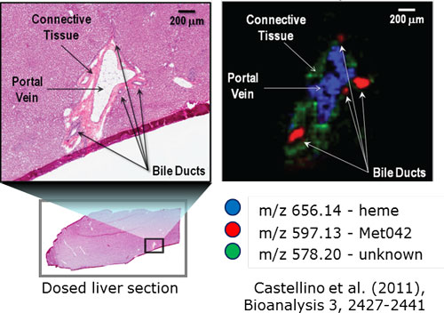 MALDI targeted imaging reveals compund localization not detectable with LC-MS/MS