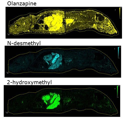 eXtreme Resolution of solariX XR can spatially differentiate ions that differ by only a few mDa and image multiple compounds per dataset.