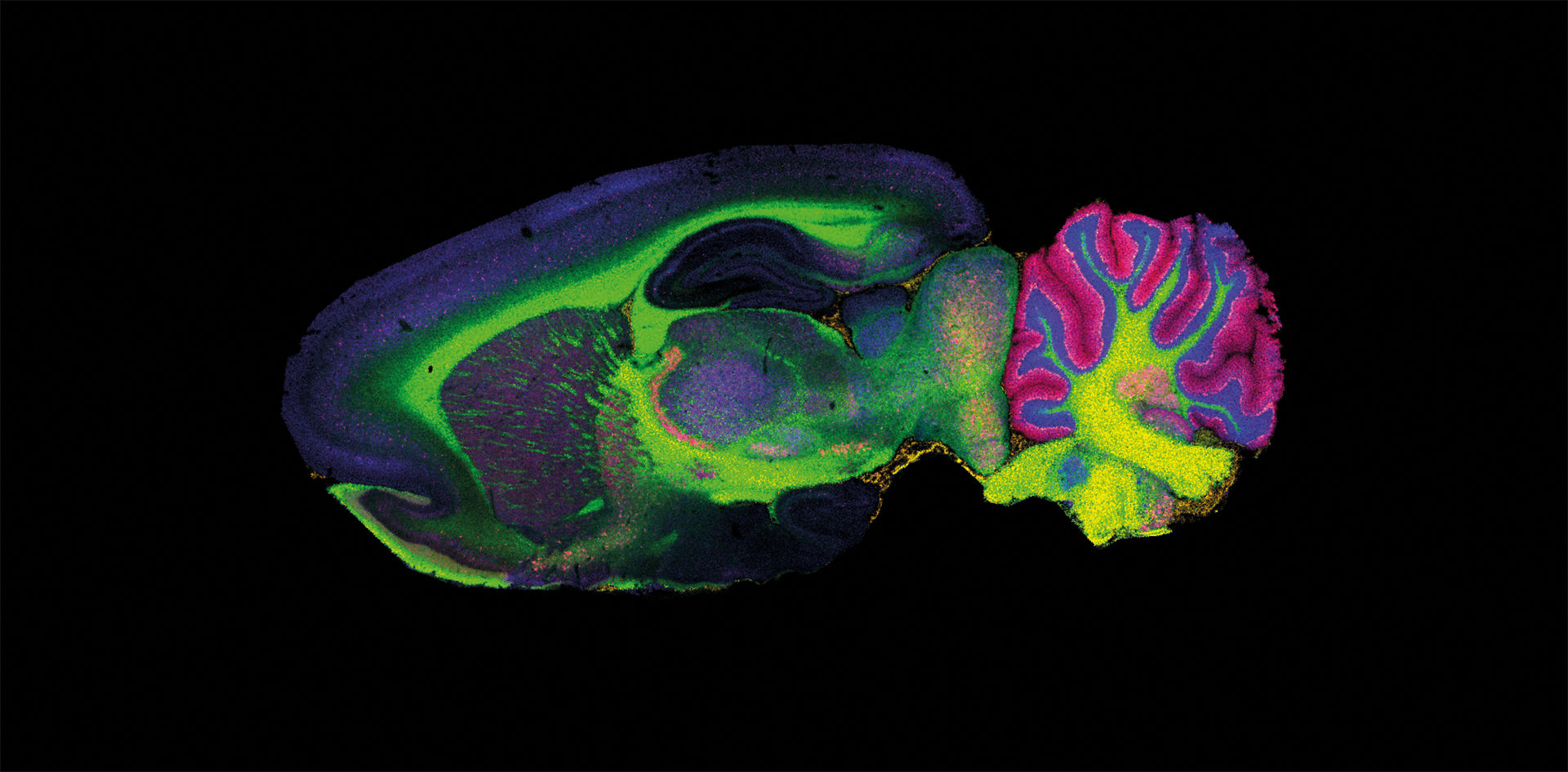 maldi imaging