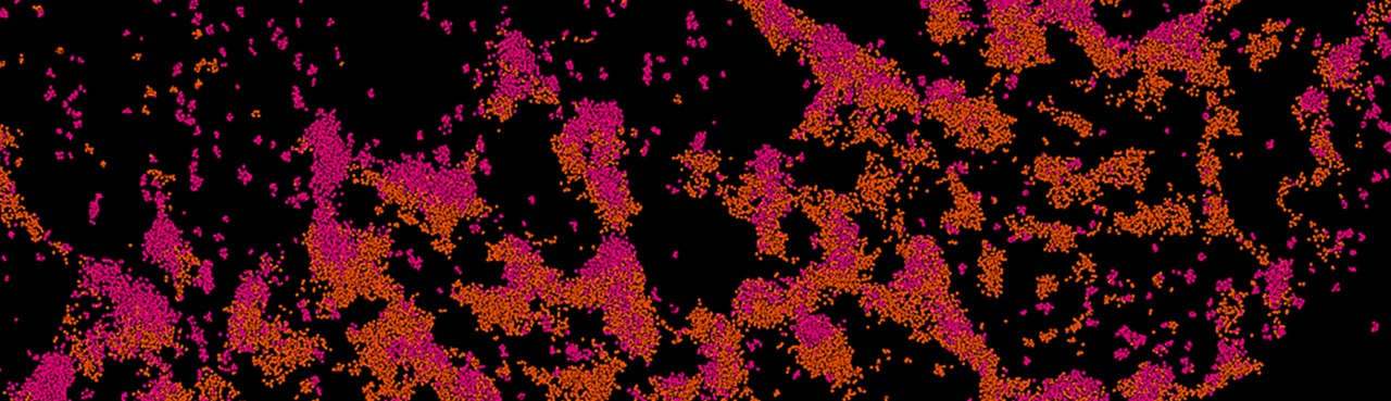 an intercalated disk from the mouse heart showing mechanical junction proteins (N-cadherin, orange) and potassium channels (pink)