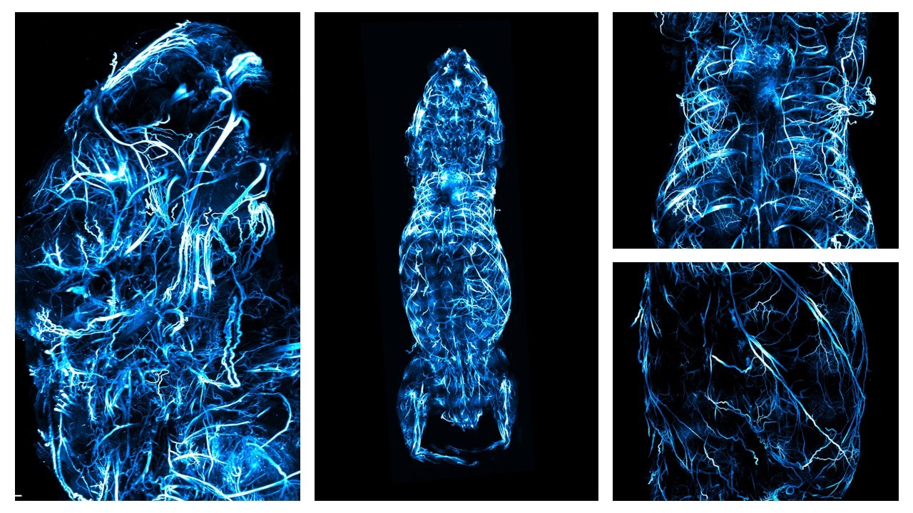 Whole mouse imaged with the LCS SPIM.