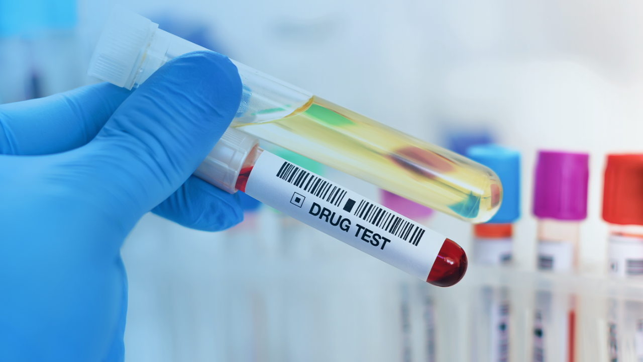 Teaser Image Drug Test Toxiology