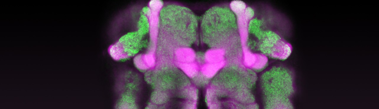 Drosophila brain imaged with two-photon microscopy