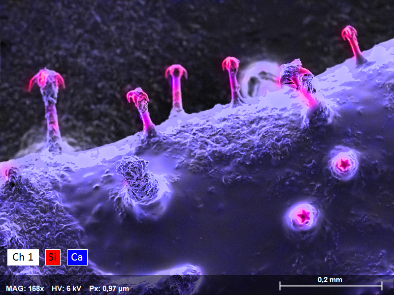 Elemental Analysis of Biological Samples using SEM EDS | Bruker