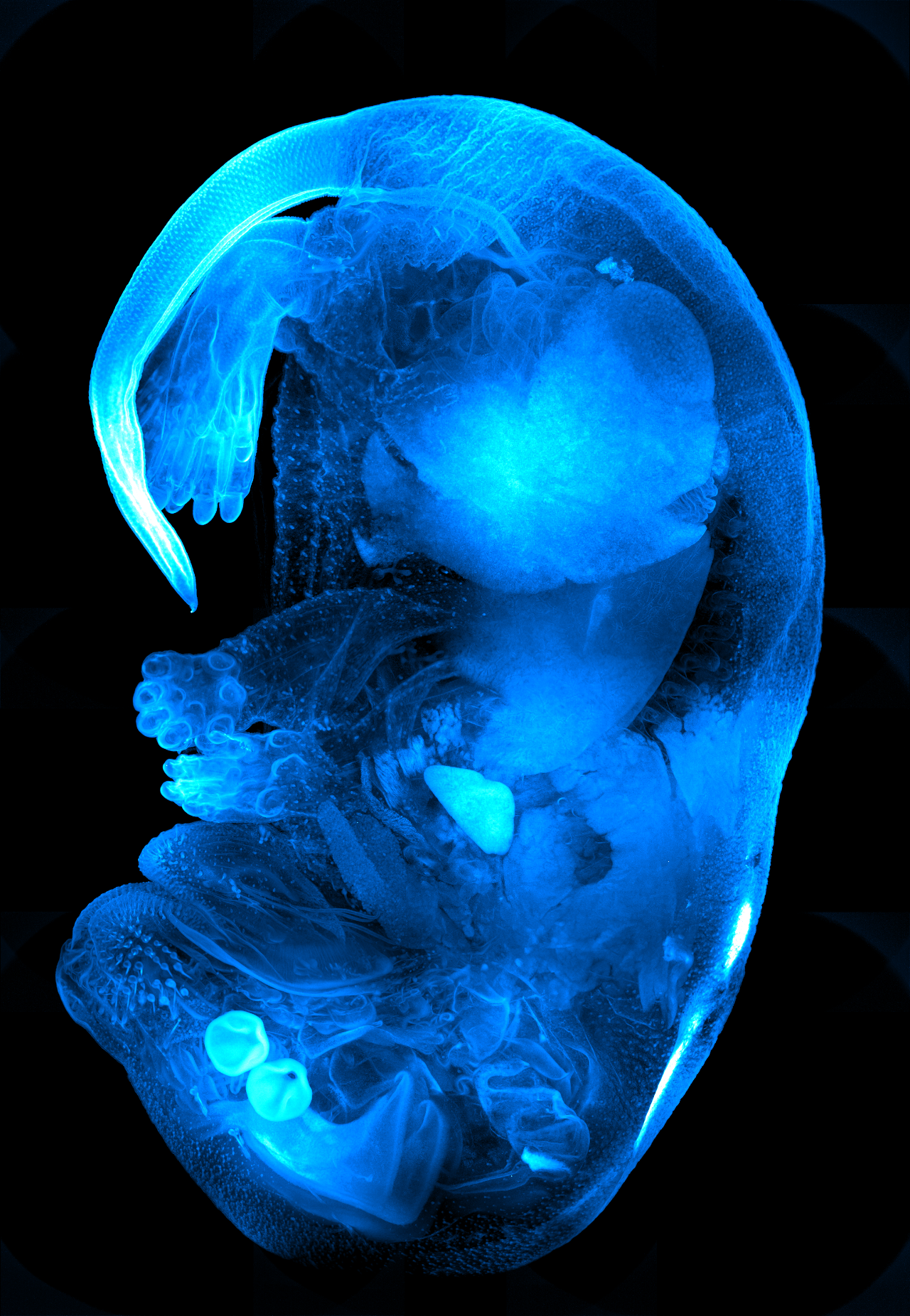 Maximum intensity projection of cleared mouse sample after the Flatfield Correction was applied