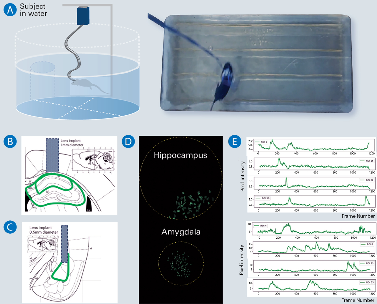 Tech Note: Deciphering Brain Function with the World's First Multi ...