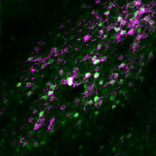 Co-expression of GCaMP6s and soma-restricted C1V1-mRuby2 in layer 5A neurons of mouse visual cortex